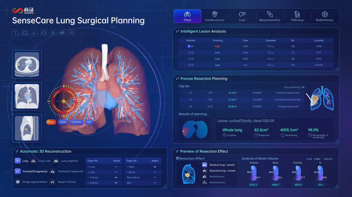 SenseCare® Imaging & Surgical Planning