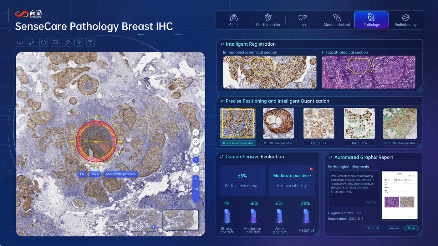 SenseCare® Smart Pathology