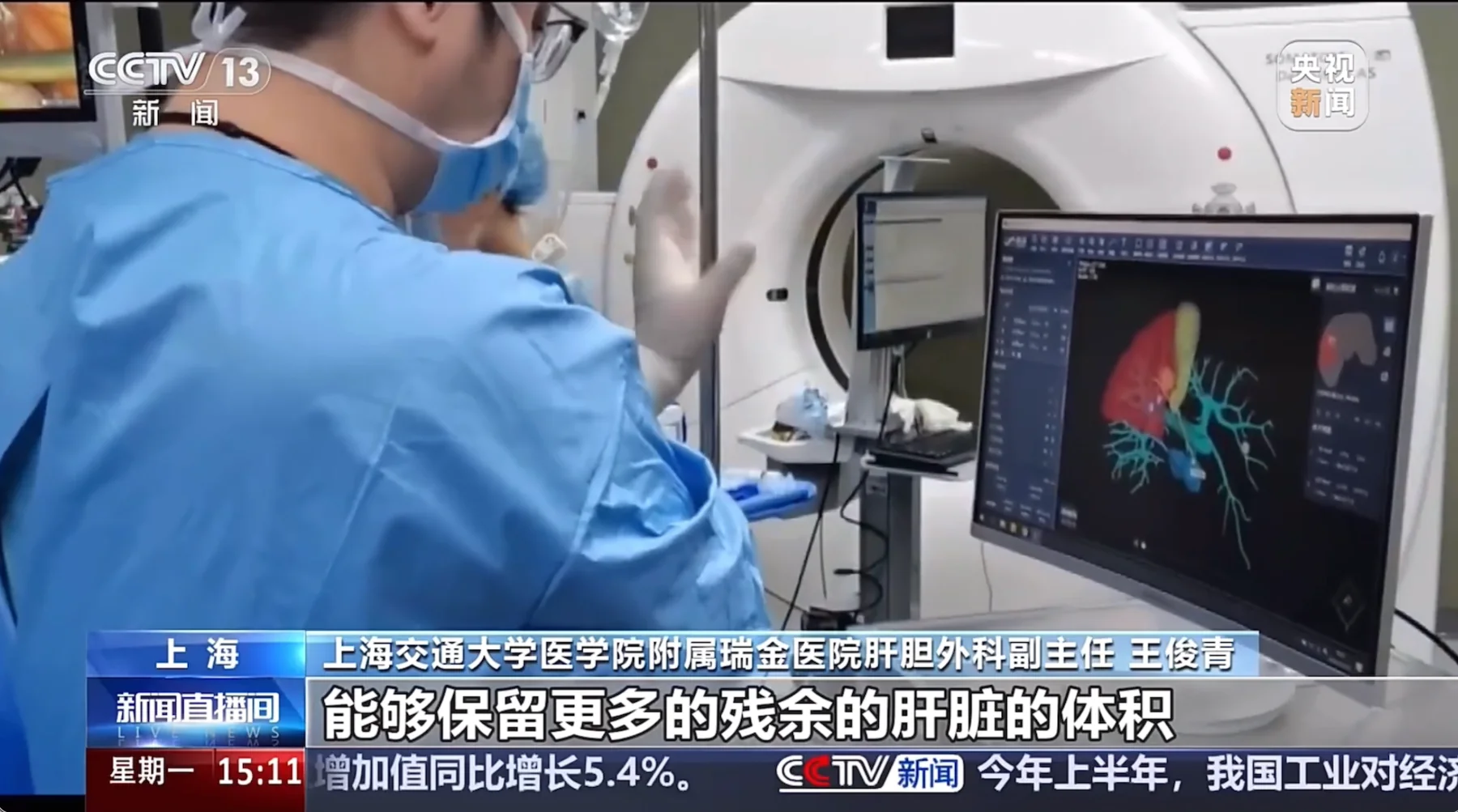SenseCare liver surgical planning used in clinical operating room workflow