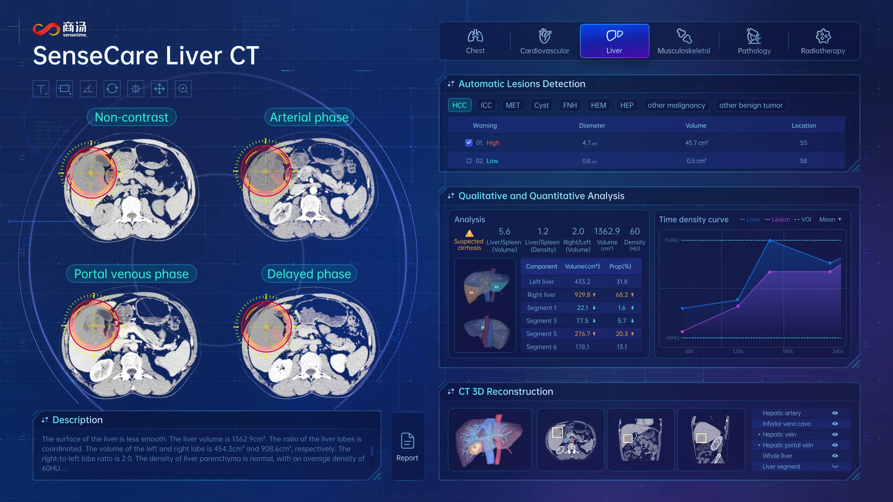SenseCare liver diagnosis and treatment integrated solution interface