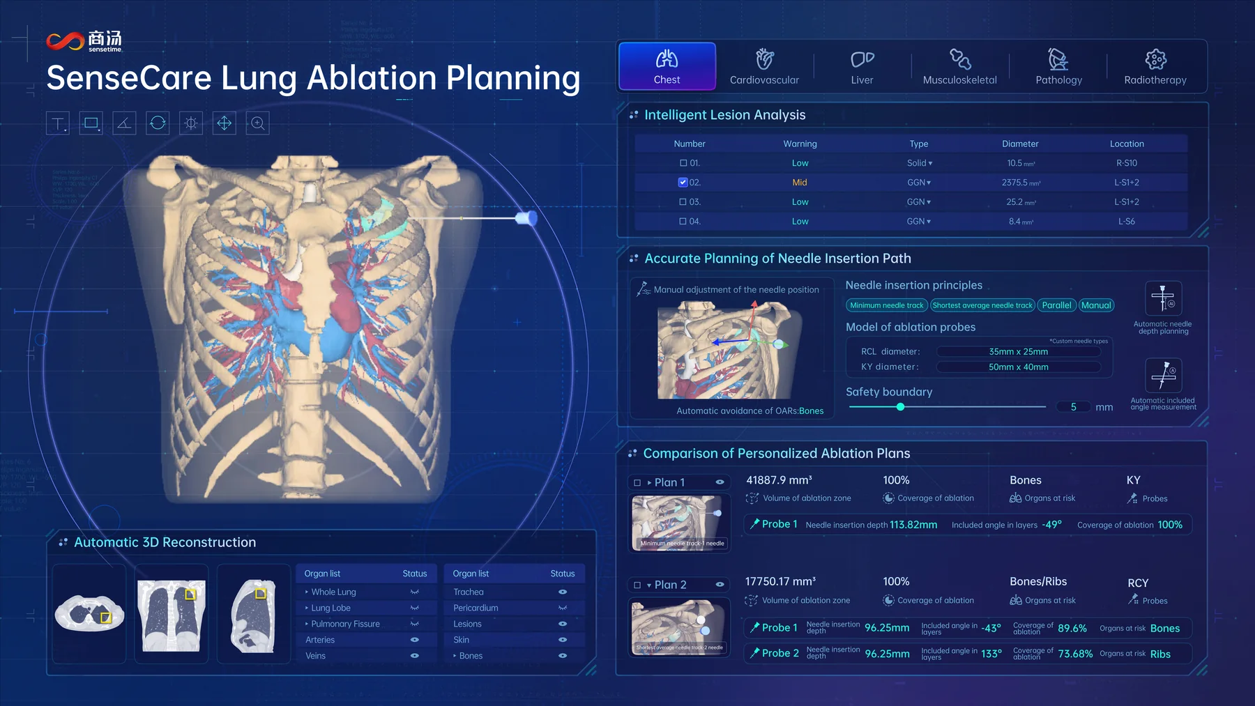SenseCare lung surgical planning resection simulation interface