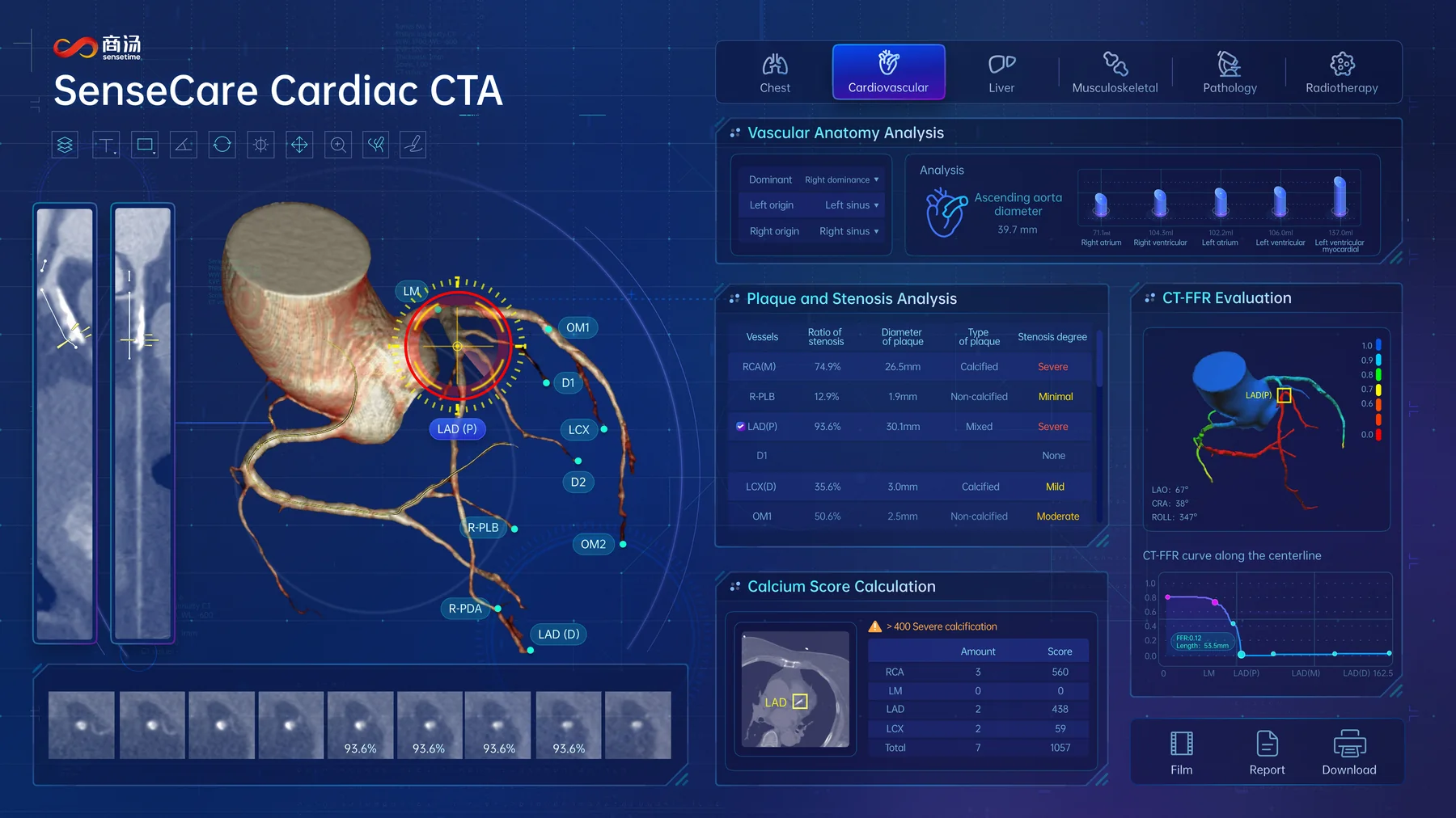SenseCare Cardiac CTA interface