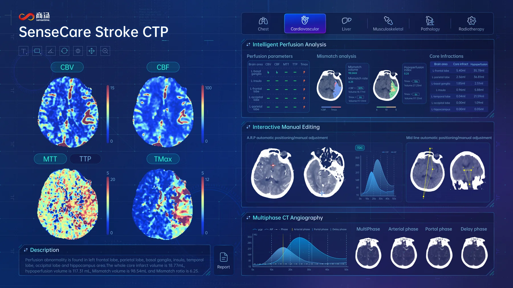 SenseCare Stroke CTP interface